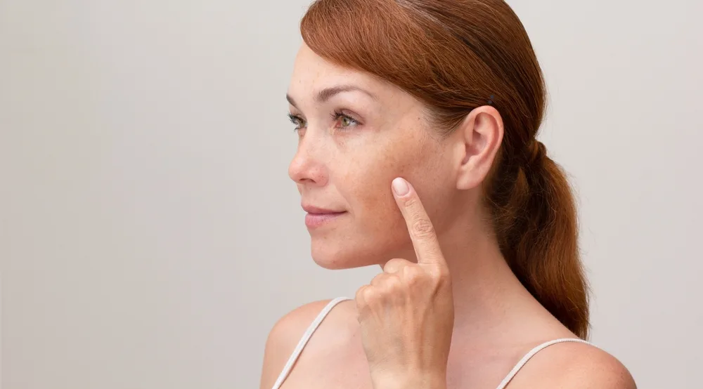 How to Get Rid of Sun Spots on Face