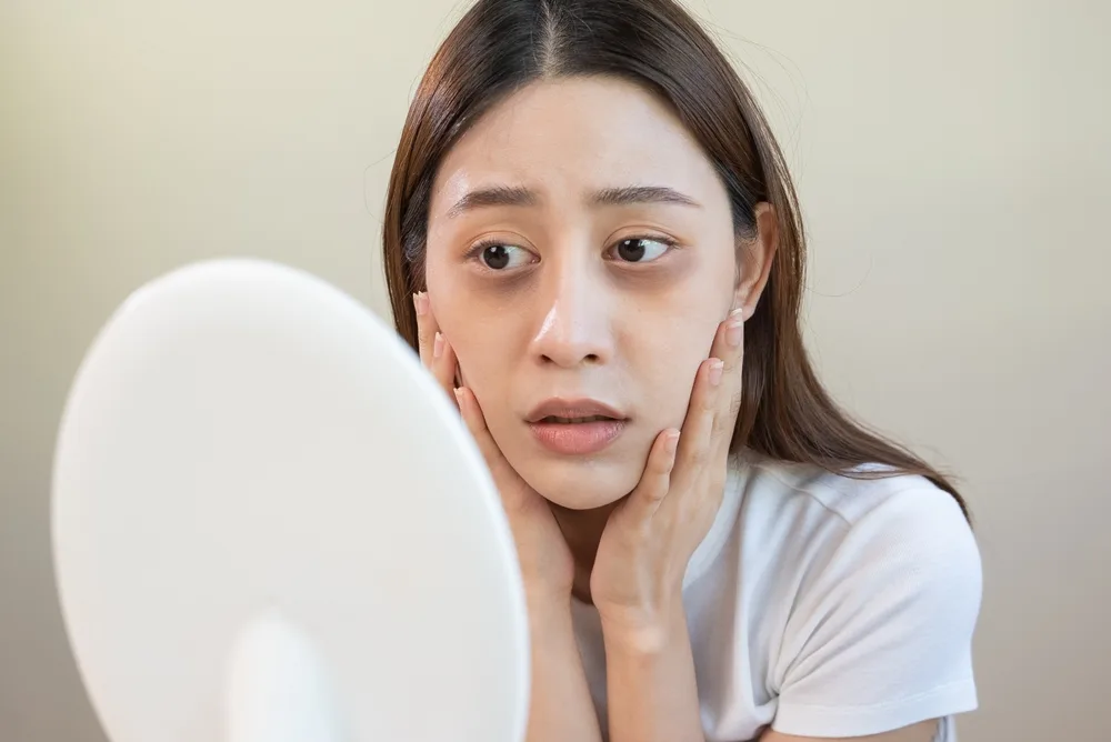 How to Get Rid of Dark Circles Under Eyes