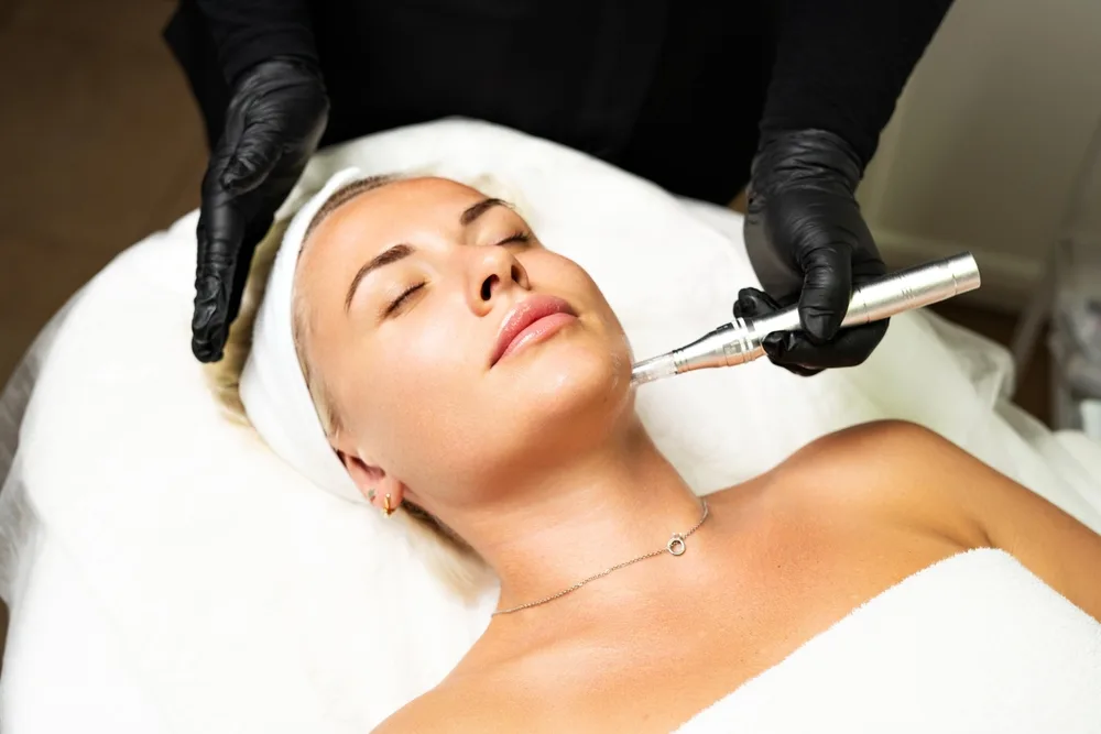 Microneedling Benefits That Don’t Get Enough Attention